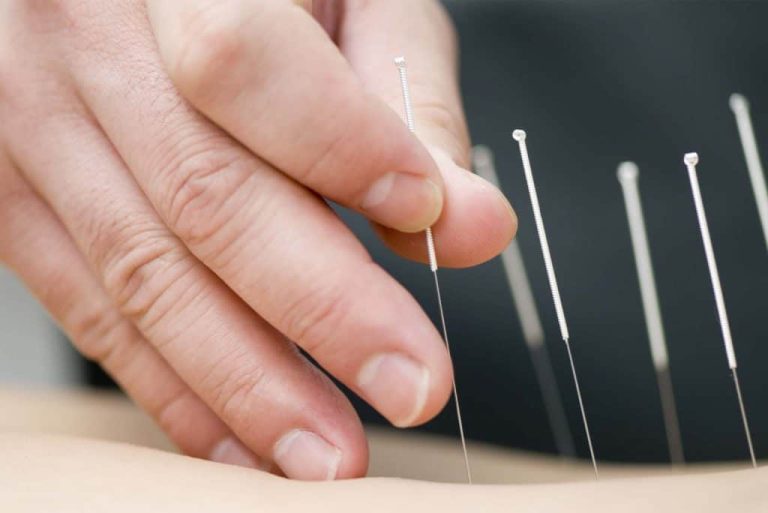 Fertility Acupuncture: A Natural Path to Conception and Reproductive Health