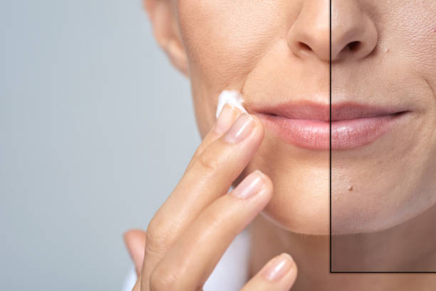 Understanding Ashen Skin: Causes, Symptoms, and Holistic Care